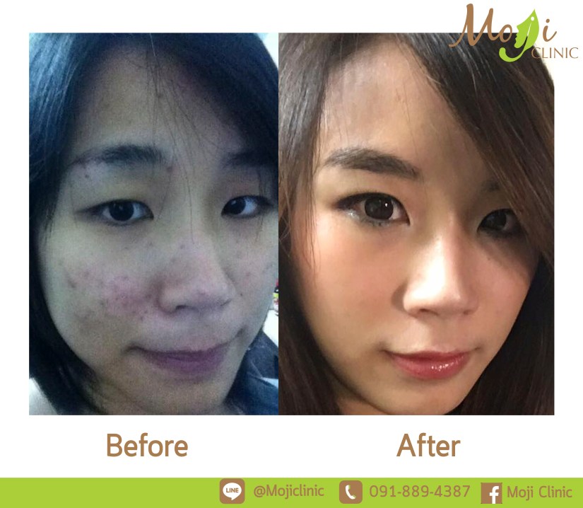 ผลงานหมอ Sung for facebook