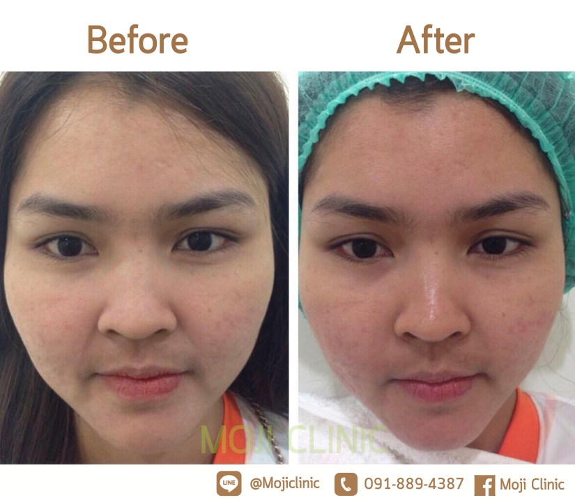 Turbofat Jane หน้าตรง1